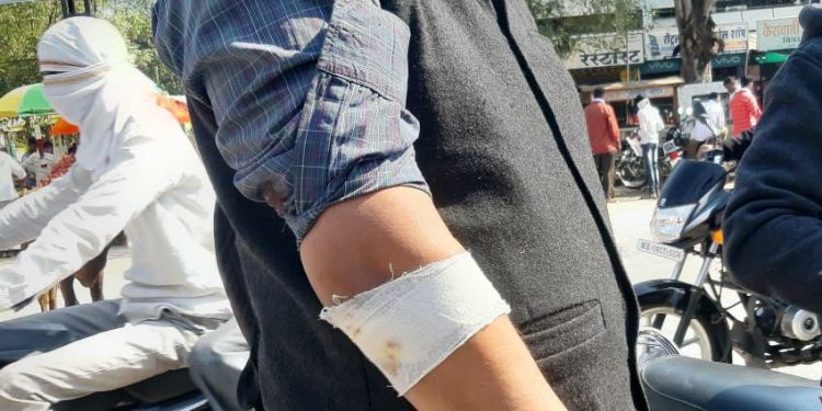 समग्र शिक्षा अभियानाचे दोन कर्मचारी जखमी अतिरिक्त पदाच्या कर्तव्यासाठी जातांना झाला अपघात