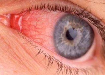 सावधान..! आता म्युकर मायकोसिस आजाराचाही धोका …