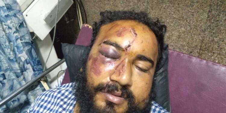 कोचुरे कुटुंबियांना बेदम मारहाण करून घरातील सामानांची केली तोडफोड