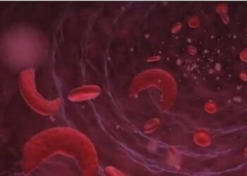 सिकलसेल ‘या’ गंभीर आजारा विषयी तुम्हाला हे माहित आहे का ?