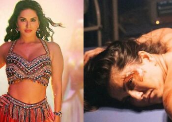 सनी लिओन झाली रक्तबंबाळ, ऑपरेशन टेबलवर पडलेला फोटो झाला व्हायरल