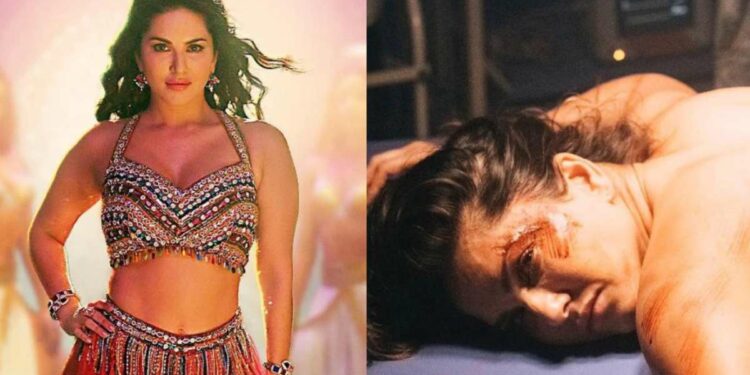 सनी लिओन झाली रक्तबंबाळ, ऑपरेशन टेबलवर पडलेला फोटो झाला व्हायरल