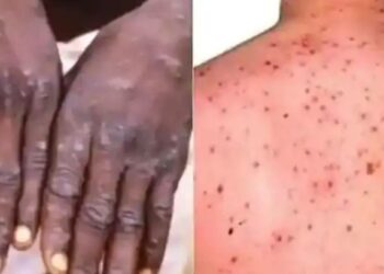 कोरोनानंतर आता ‘या’ विषाणूने वाढवले जगाचे टेन्शन