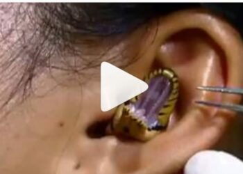 ‘बीळ’ समजून ‘साप’ घुसला मुलीच्या कानात : सोशल मीडियावर एक धक्कादायक व्हिडीओ व्हायरल