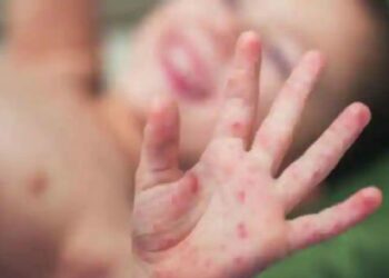 मुलांमध्ये हा आजाराचा झपाट्याने पसरतोय.. संसर्ग घातक असू शकतो ; जाणून घ्या काय आहेत लक्षणे