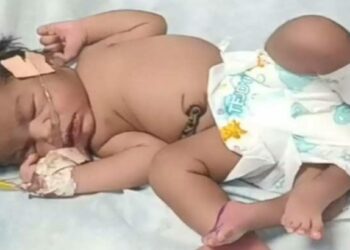 अजब ! महिलेने दिला चार पाय असलेल्या मुलीला जन्म , लोक म्हणाले..