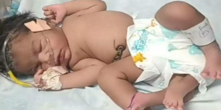 अजब ! महिलेने दिला चार पाय असलेल्या मुलीला जन्म , लोक म्हणाले..