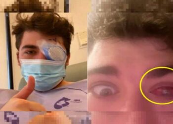 अरे देवा..! झोपेतून उठला अन् एका डोळ्याची दृष्टी गेली, ती एक चूक चांगलीच भोवली