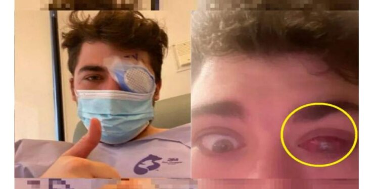 अरे देवा..! झोपेतून उठला अन् एका डोळ्याची दृष्टी गेली, ती एक चूक चांगलीच भोवली