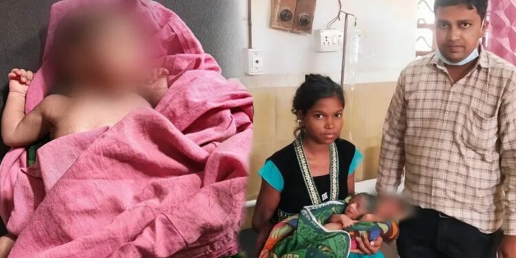 अजबच ! जळगावात महिलेने दिला २६ बोटांच्या बाळाला जन्म