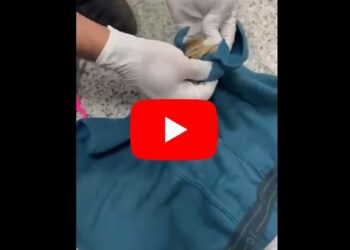 अंडरवेअरमधून सोन्याची तस्करी ; हा VIDEO पाहून तुम्हीही तस्करीवाल्याला सॅल्यूट कराल