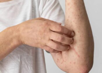 त्वचेवर खाज येणे हे ‘या’ धोकादायक आजाराचे लक्षण, त्वरित उपचार करा