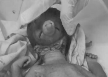 ‘भगवान गणेशा’सारखा चेहरा असलेल्या मुलाचा जन्म, पण.. ; डॉक्टरांनाही बसला धक्का