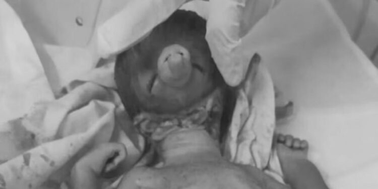 ‘भगवान गणेशा’सारखा चेहरा असलेल्या मुलाचा जन्म, पण.. ; डॉक्टरांनाही बसला धक्का