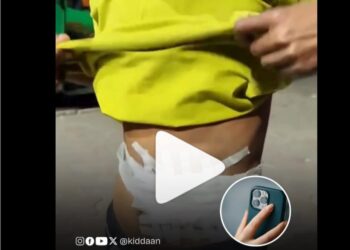 “प्रेमात वेडा… प्रेयसीला आयफोन प्रो घेऊन देण्यासाठी किडनी विकली ; व्हिडीओ व्हायरल!