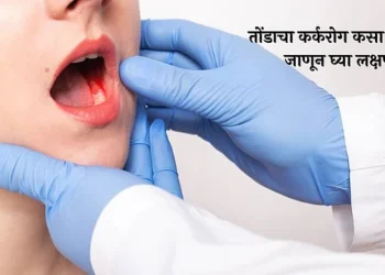 Mouth Cancer Symptoms