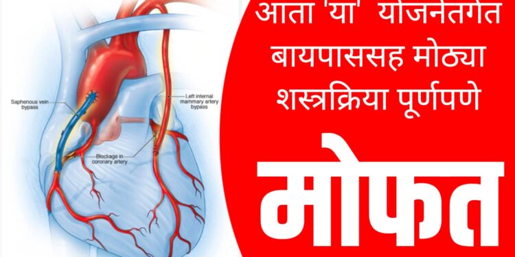Free Bypass Surgery : आता 'या' योजने अंतर्गत योजनेंतर्गत बायपाससह मोठ्या शस्त्रक्रिया पूर्णपणे मोफत